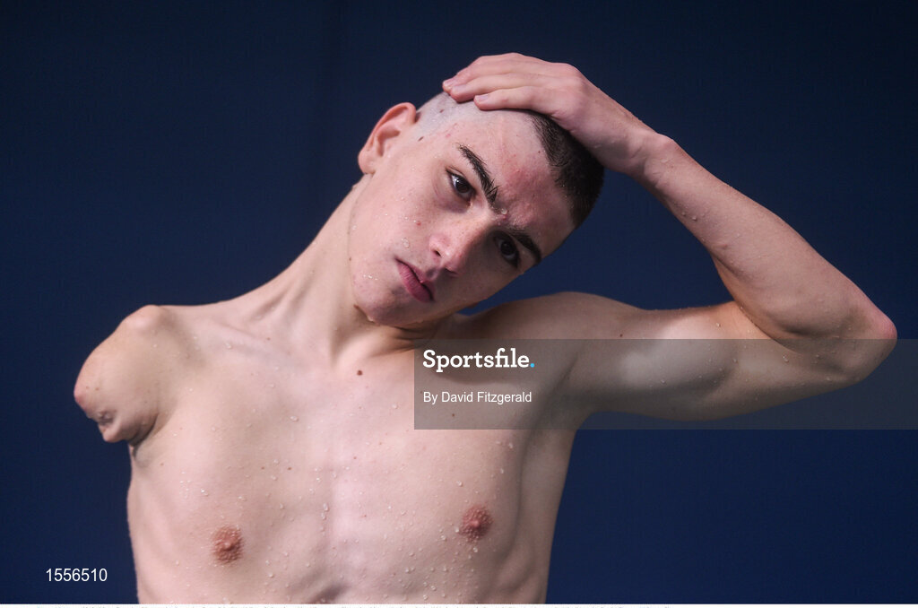 16 August 2018; Diogo Cancela of Portugal prior to day four of the World Para Swimming Allianz European Championships at the Sport Ireland National Aquatic Centre in Blanchardstown, Dublin. Photo by David Fitzgerald/Sportsfile