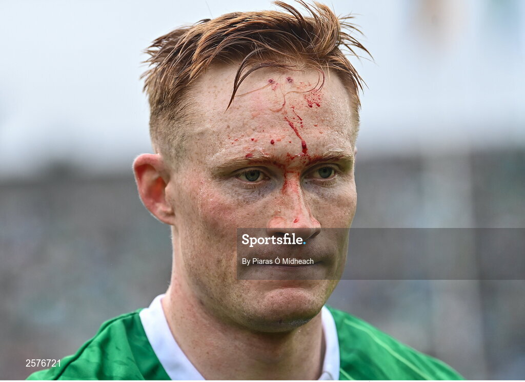23 July 2023; William O'Donoghue of Limerick after his side's victory in the GAA Hurling All-Ireland Senior Championship final match between Kilkenny and Limerick at Croke Park in Dublin. Photo by Piaras Ó Mídheach/Sportsfile