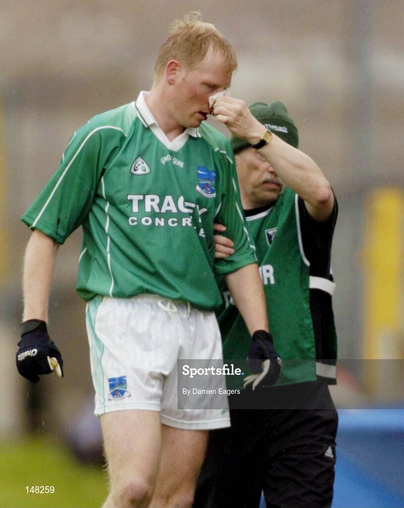 24 July 2004; Fermanagh's Liam McBarron is helped off the field after receiving a blood injury. Bank of Ireland Senior Football Championship Qualifier, Round 4, Fermanagh v Donegal, Tighernach's Park, Clones. Co. Monaghan. Picture credit; Damien Eagers / SPORTSFILE
