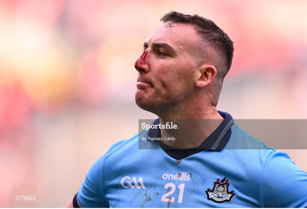 5 July 2025; John Hetherton of Dublin after his side's defeat in the GAA Hurling All-Ireland Senior Championship semi-final match between Cork and Dublin at Croke Park in Dublin. Photo by Ramsey Cardy/Sportsfile