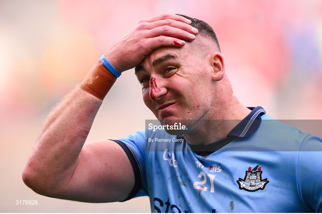 5 July 2025; John Hetherton of Dublin after his side's defeat in the GAA Hurling All-Ireland Senior Championship semi-final match between Cork and Dublin at Croke Park in Dublin. Photo by Ramsey Cardy/Sportsfile