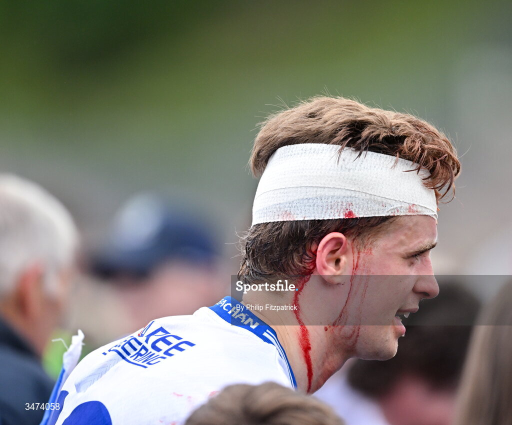 31 May 2026; (EDITORS NOTE: Image contains graphic content) Karl Gallagher of Monaghan after  the GAA Football All-Ireland Senior Championship Round 1 match between Monaghan and Mayo at St Tiernach's Park in Clones, Monaghan. Photo by Philip Fitzpatrick/Sportsfile