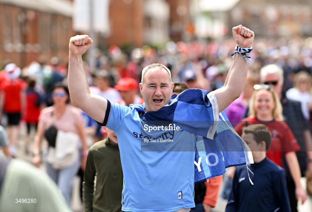 28 June 2026; Dublin supporter Colin Molloy from Tallaght, Dublin, before the GAA Football All-Ireland Senior Championship quarter-final match between Dublin and Galway at Croke Park in Dublin. Photo by Sam Barnes/Sportsfile