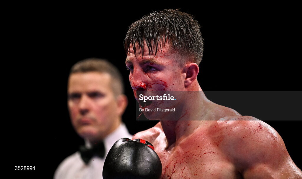 1 August 2026; (EDITORS NOTE: Image contains graphic content) Pierce O'Leary during his IBO World Super Lightweight Title bout against Mark Chamberlain during the Boxing in Dublin event at the 3Arena in Dublin. Photo by David Fitzgerald/Sportsfile