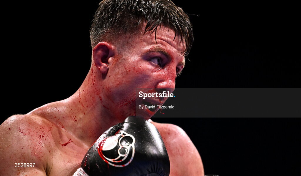 1 August 2026; (EDITORS NOTE: Image contains graphic content) Pierce O'Leary during his IBO World Super Lightweight Title bout against Mark Chamberlain during the Boxing in Dublin event at the 3Arena in Dublin. Photo by David Fitzgerald/Sportsfile