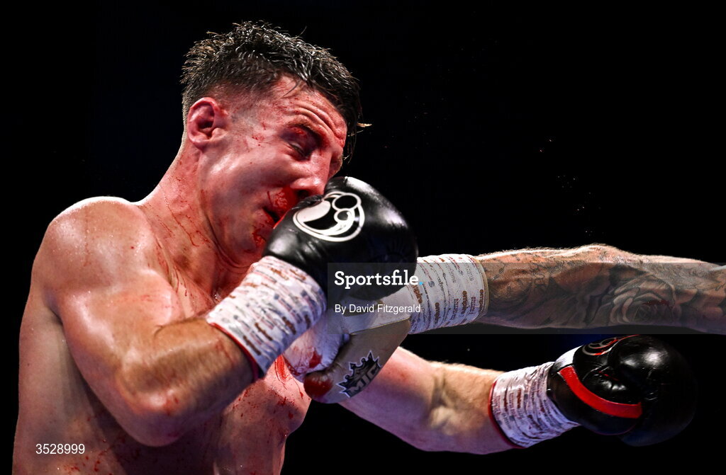 1 August 2026; (EDITORS NOTE: Image contains graphic content) Pierce O'Leary during his IBO World Super Lightweight Title bout against Mark Chamberlain during the Boxing in Dublin event at the 3Arena in Dublin. Photo by David Fitzgerald/Sportsfile