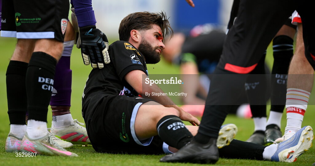 2 August 2026; (EDITORS NOTE: Image contains graphic content) Brandon Fleming of Derry City after picking up a head injury during the SSE Airtricity Men's Premier Division match between St Patrick's Athletic and Derry City at Richmond Park in Dublin. Photo by Stephen McCarthy/Sportsfile