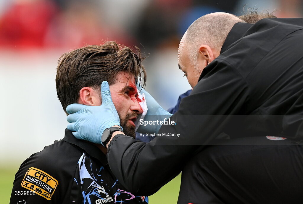 2 August 2026; (EDITORS NOTE: Image contains graphic content) Brandon Fleming of Derry City receives medical attention from physiotherapist Colum O'Neill after picking up a head injury during the SSE Airtricity Men's Premier Division match between St Patrick's Athletic and Derry City at Richmond Park in Dublin. Photo by Stephen McCarthy/Sportsfile