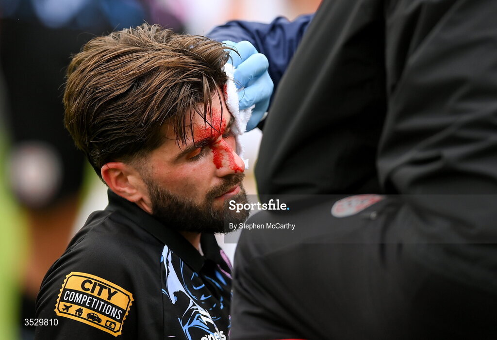 2 August 2026; (EDITORS NOTE: Image contains graphic content) Brandon Fleming of Derry City receives medical attention after picking up a head injury during the SSE Airtricity Men's Premier Division match between St Patrick's Athletic and Derry City at Richmond Park in Dublin. Photo by Stephen McCarthy/Sportsfile