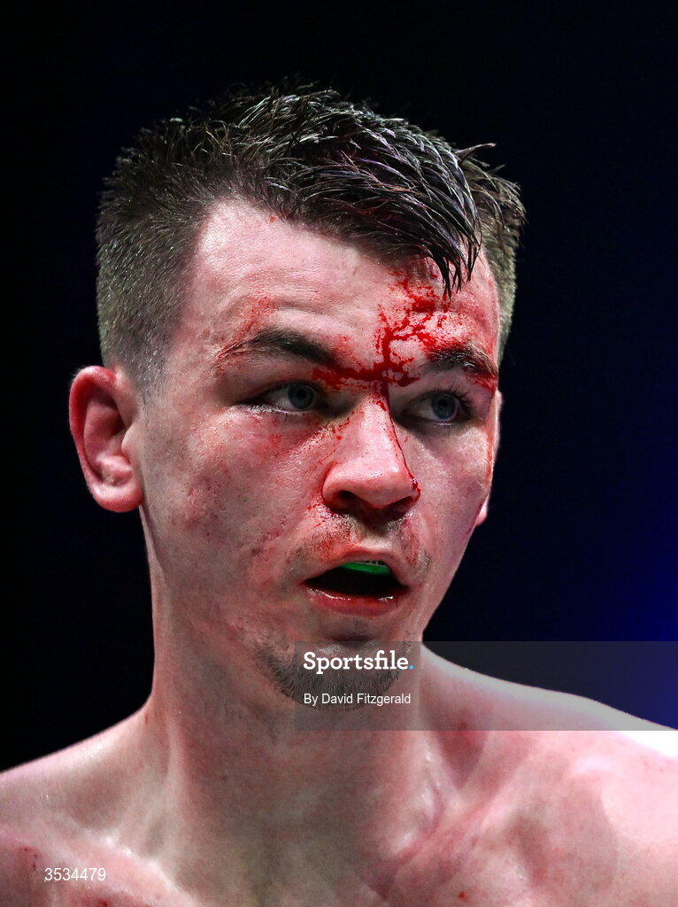 8 August 2026; (EDITORS NOTE: Image contains graphic content) Blood is seen on the face of Aaron McKenna during their world middleweight title bout during the Zuffa Boxing 10 event at the 3Arena in Dublin. Photo by David Fitzgerald/Sportsfile