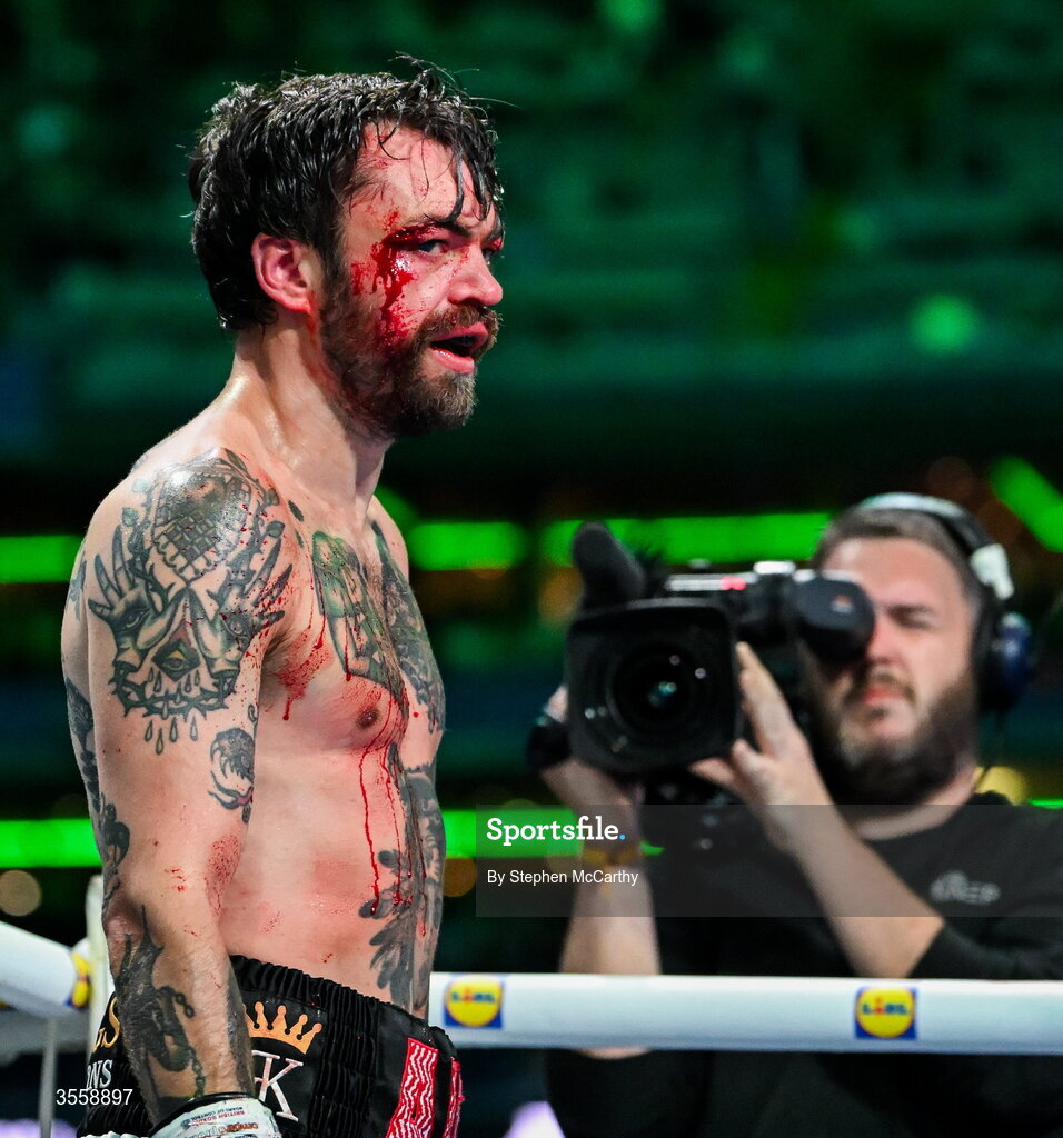 5 September 2026; (EDITORS NOTE: Image contains graphic content) Tyrone McKenna after his welterweight bout defeat against Paddy Donovan at the Once Upon A Time fight night in Croke Park, Dublin. Photo by Stephen McCarthy/Sportsfile
