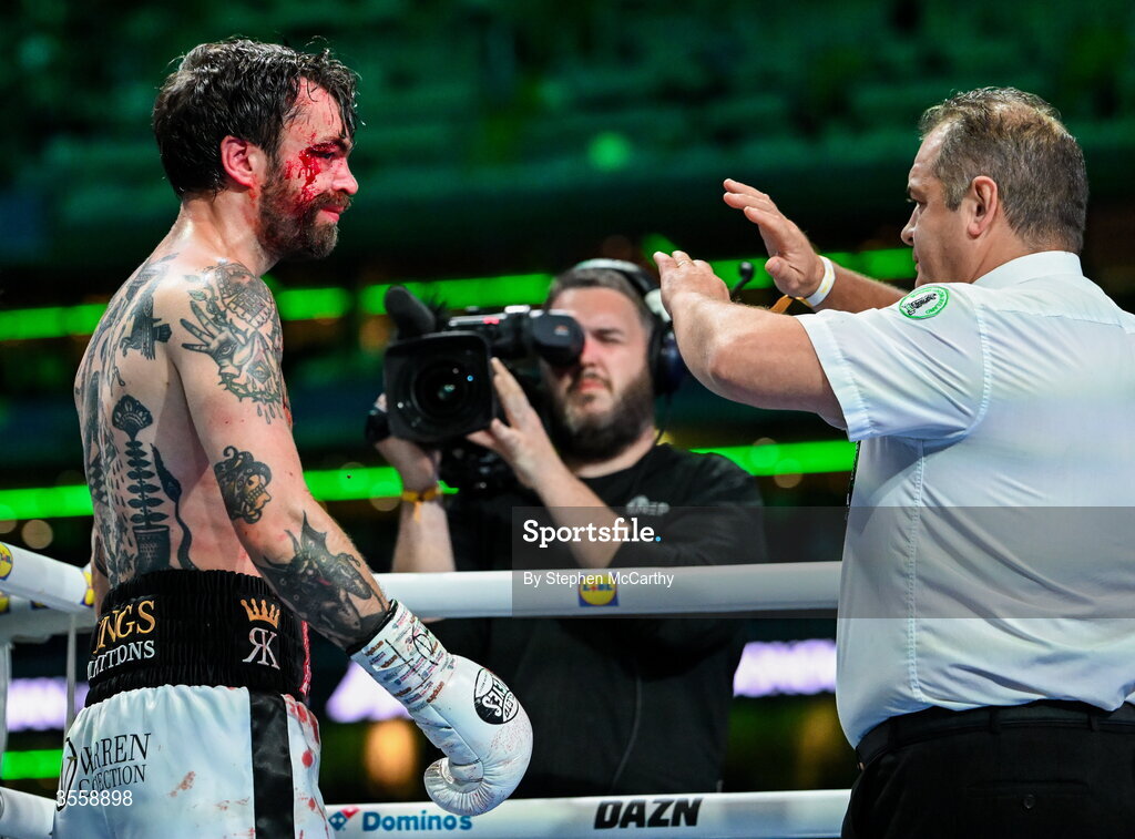 5 September 2026; (EDITORS NOTE: Image contains graphic content) Tyrone McKenna after his welterweight bout defeat against Paddy Donovan at the Once Upon A Time fight night in Croke Park, Dublin. Photo by Stephen McCarthy/Sportsfile