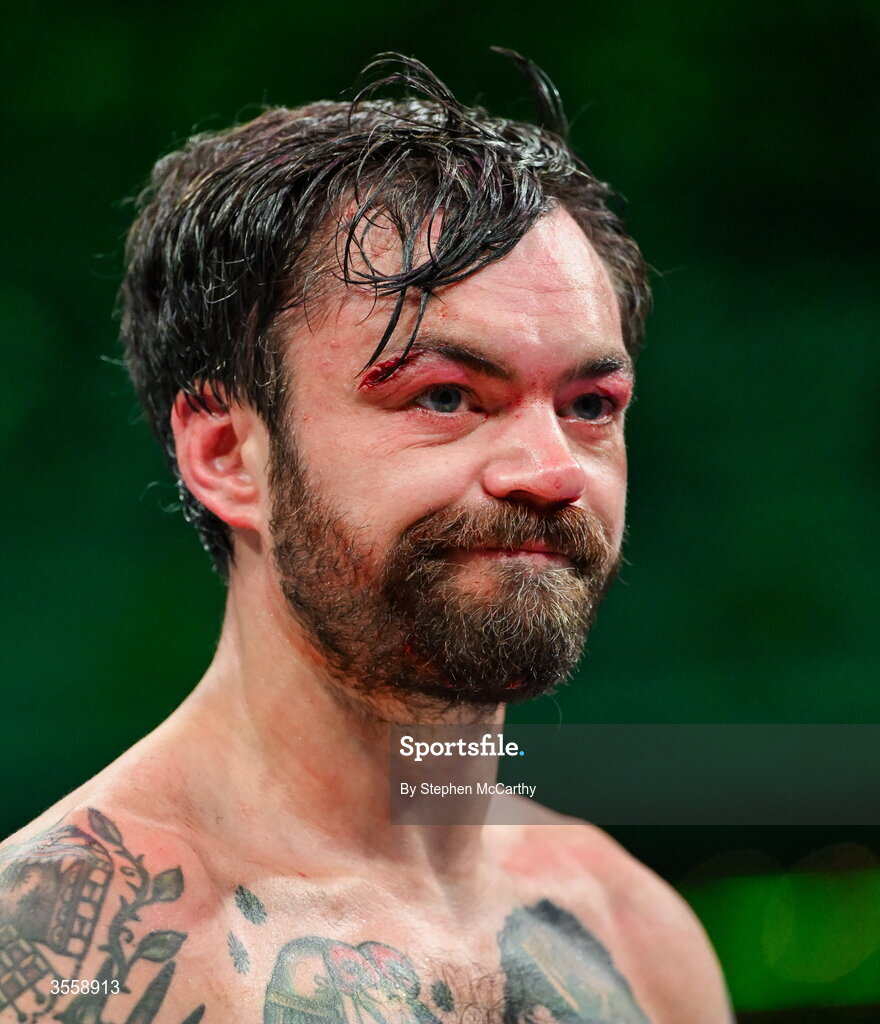 5 September 2026; Tyrone McKenna after his defeat in his welterweight bout against Paddy Donovan at the Once Upon A Time fight night in Croke Park, Dublin. Photo by Stephen McCarthy/Sportsfile