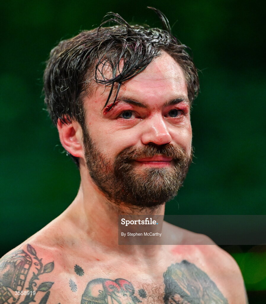 5 September 2026; Tyrone McKenna after his defeat in his welterweight bout against Paddy Donovan at the Once Upon A Time fight night in Croke Park, Dublin. Photo by Stephen McCarthy/Sportsfile