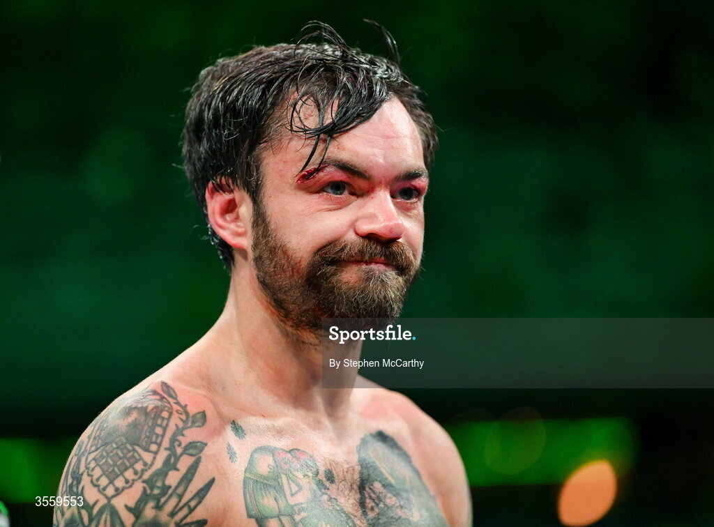 5 September 2026; Tyrone McKenna after his defeat in his welterweight bout against Paddy Donovan at the Once Upon A Time fight night in Croke Park, Dublin. Photo by Stephen McCarthy/Sportsfile