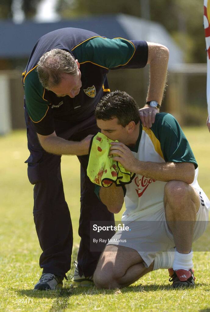 18 October 2005; Dr. Con Murphy attends to team captain Padraic Joyce, who suffered from a nose bleed, during a training session, at the Mandurah Football and Sports Club, in advance of the Fosters International Rules game between Australia and Ireland. Mandurah Football and Sports Club, Rushton Park, Mandurah, Perth, Western Australia. Picture credit; Ray McManus / SPORTSFILE