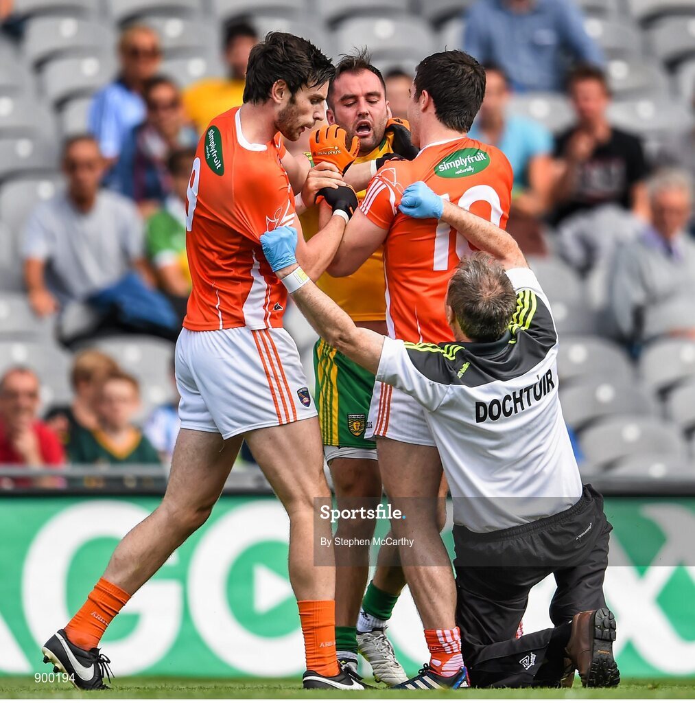 9 August 2014; Donegal team doctor Kevin Moran tries to seperate Armagh's Aaron Findon, left, from Aidan Forker and Donegal's Karl Lacey. GAA Football All-Ireland Senior Championship, Quarter-Final, Donegal v Armagh, Croke Park, Dublin. Picture credit: Stephen McCarthy / SPORTSFILE
