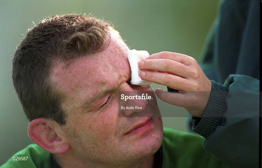 29 September 1999; David Corkery has his eye attended to by the team physiotherapist Denise Fanagan during an Ireland Rugby training session at King's Hospital in Palmerstown, Dublin. Photo by Aoife Rice/Sportsfile