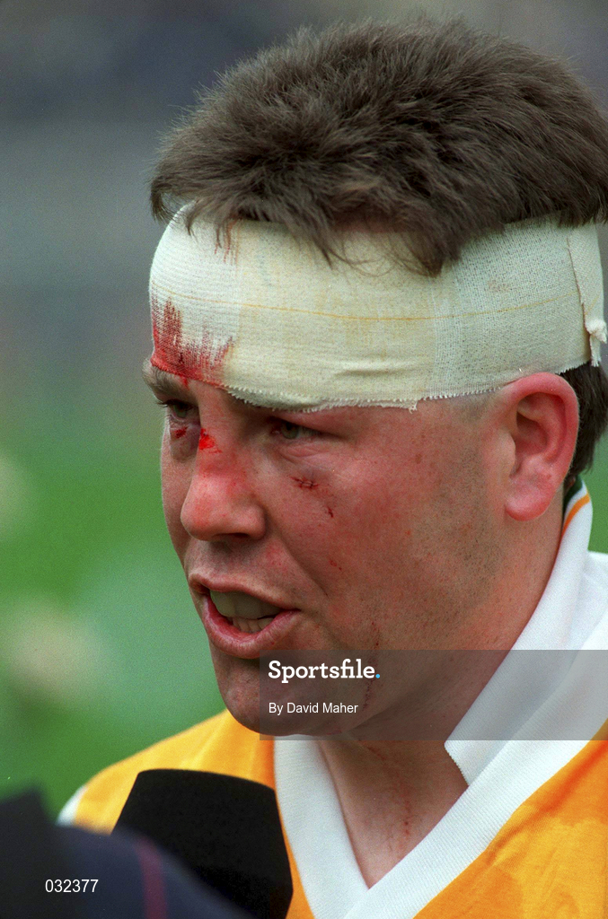 7 August 1994; Limerick's Gary Kirby is interviewed following the All-Ireland Senior Hurling Championship Semi-Final match between Limerick and Antrim at Croke Park in Dublin. Photo by David Maher/Sportsfile