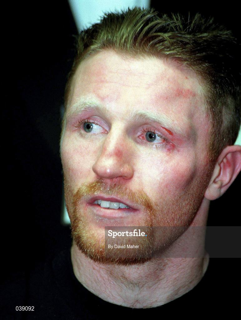 18 March 1995; Steve Collins shows the scars of battle following victory during his WBO Super-Middleweight Title Fight against Chris Eubank at Green Glens Arena in Millstreet, Cork Boxing. Photo by David Maher/Sportsfile