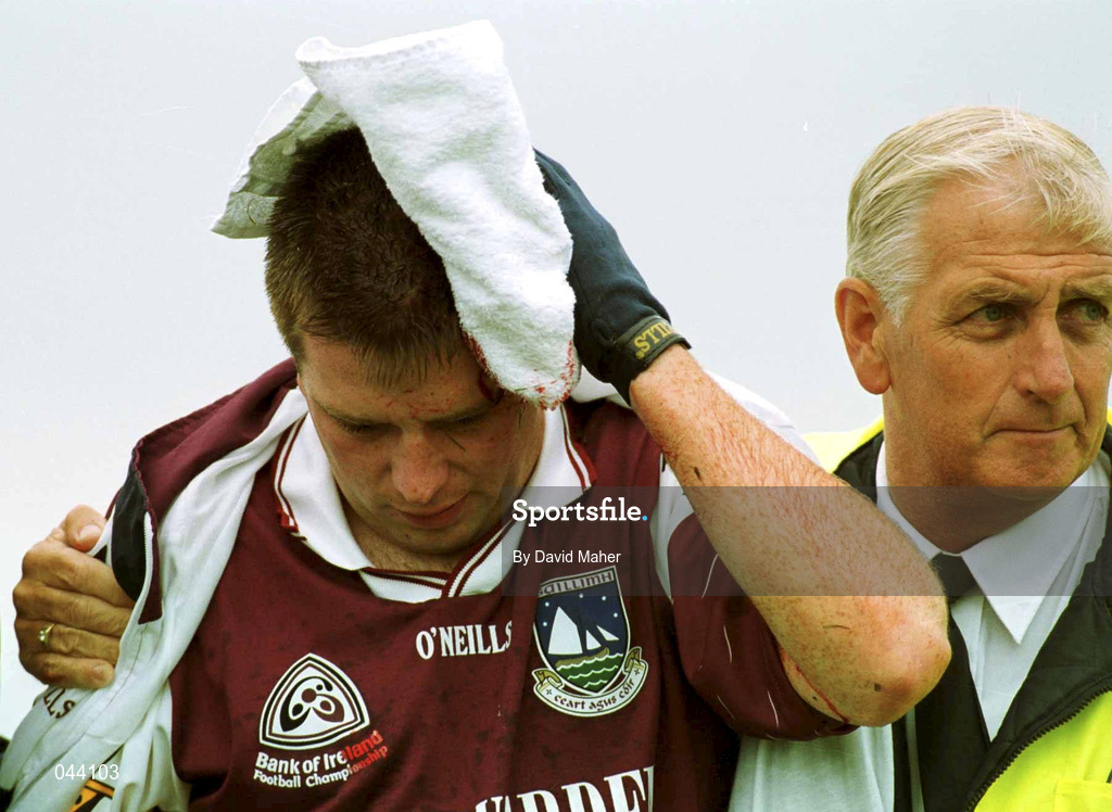 30 July 2000; Galway's Tommy Joyce is led away for attention to a head injury during the opening minutes of the Bank of Ireland Connacht Senior Football Championship Final between Galway and Leitrim at Dr Hyde Park in Roscommon. Photo by David Maher/Sportsfile