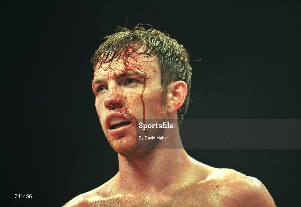19 July 2008; Andy Lee during the final round against Willie Gibbs. International Middleweight contest, University Sports Arena, Limerick. Picture credit: David Maher / SPORTSFILE