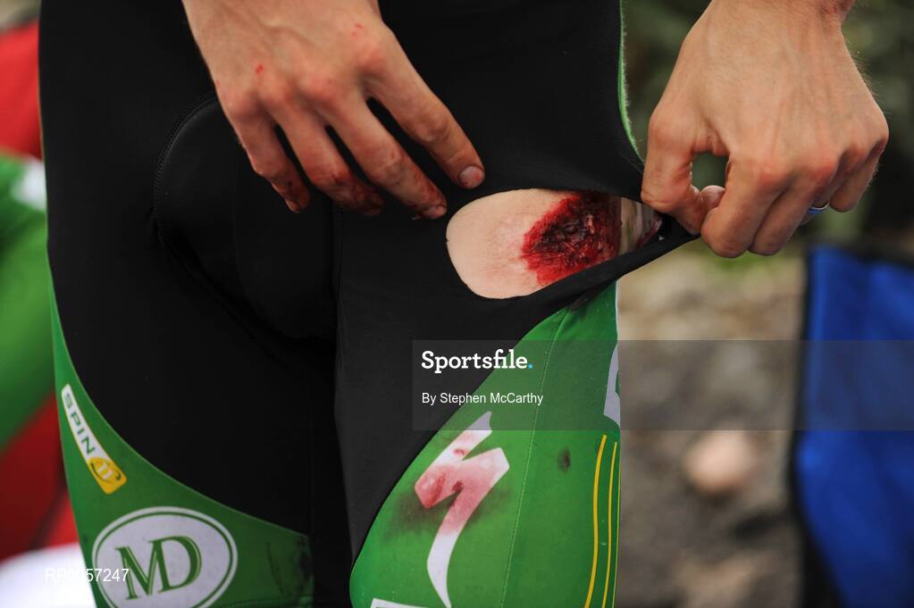 29 August 2008; Daniel Lloyd, of the An Post sponsored Sean Kelly team, examines his cuts after falling towards the end of the stage. 2008 Tour of Ireland - Stage 3, Ballinrobe - Galway. Picture credit: Stephen McCarthy / SPORTSFILE  *** Local Caption ***