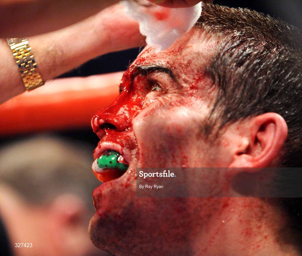 15 November 2008; Bernard Dunne, who suffered a cut to the head against Cristian Faccio which resulted in the fight being stopped, Hunky Dory Fight Night, Breaffy House Hotel, Mayo. Picture credit: Ray Ryan / SPORTSFILE