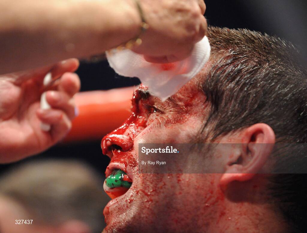 15 November 2008; Bernard Dunne after suffering a cut to the head from Cristian Faccio, which resulted in the fight being stopped. Hunky Dory Fight Night, Breaffy House Hotel, Mayo. Picture credit: Ray Ryan / SPORTSFILE