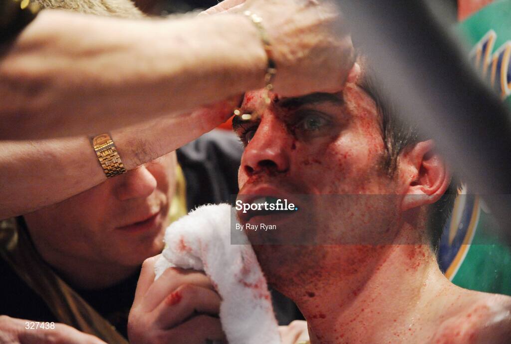 15 November 2008; Bernard Dunne after suffering a cut to the head from Cristian Faccio, which resulted in the fight being stopped. Hunky Dory Fight Night, Breaffy House Hotel, Mayo. Picture credit: Ray Ryan / SPORTSFILE