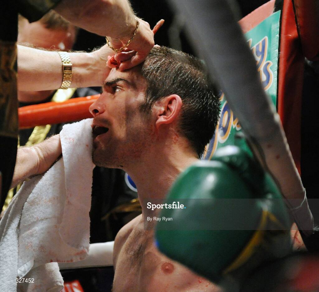 15 November 2008; Bernard Dunne after suffering a cut to the head from Cristian Faccio, which resulted in the fight being stopped. Hunky Dory Fight Night, Breaffy House Hotel, Mayo. Picture credit: Ray Ryan / SPORTSFILE