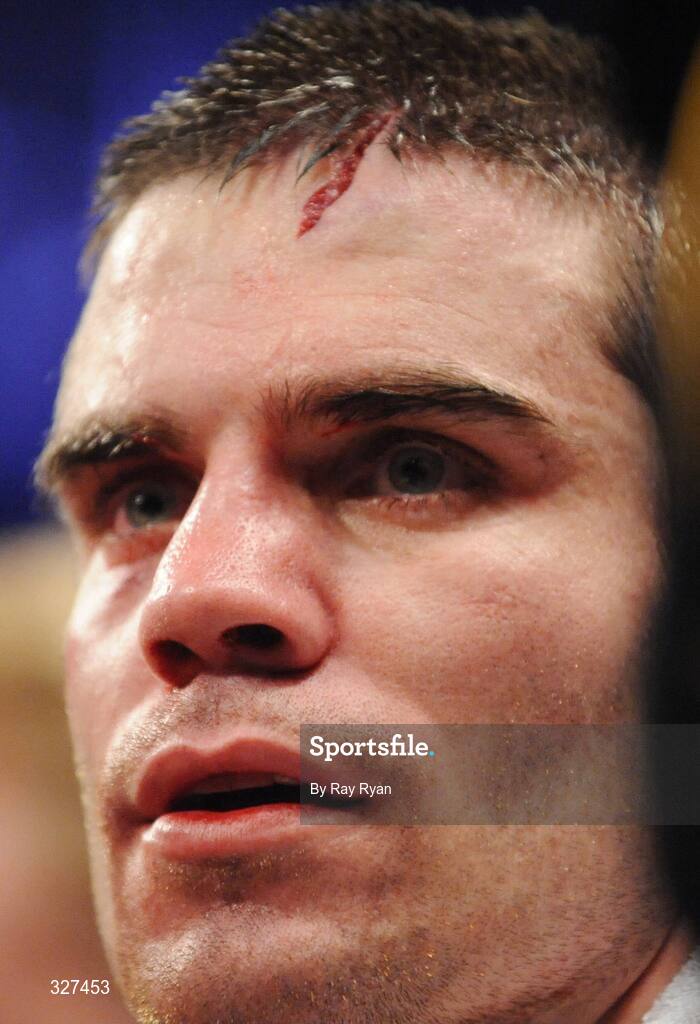 15 November 2008; Bernard Dunne after suffering a cut to the head from Cristian Faccio, which resulted in the fight being stopped. Hunky Dory Fight Night, Breaffy House Hotel, Mayo. Picture credit: Ray Ryan / SPORTSFILE
