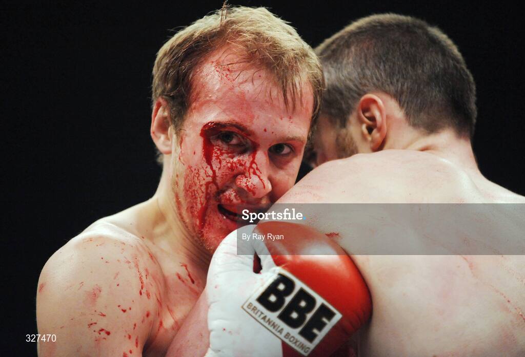 15 November 2008; Jevgenijs Fjordoys during his fight against Damian Taggart. Hunky Dory Fight Night, Breaffy House Hotel, Mayo. Picture credit: Ray Ryan / SPORTSFILE