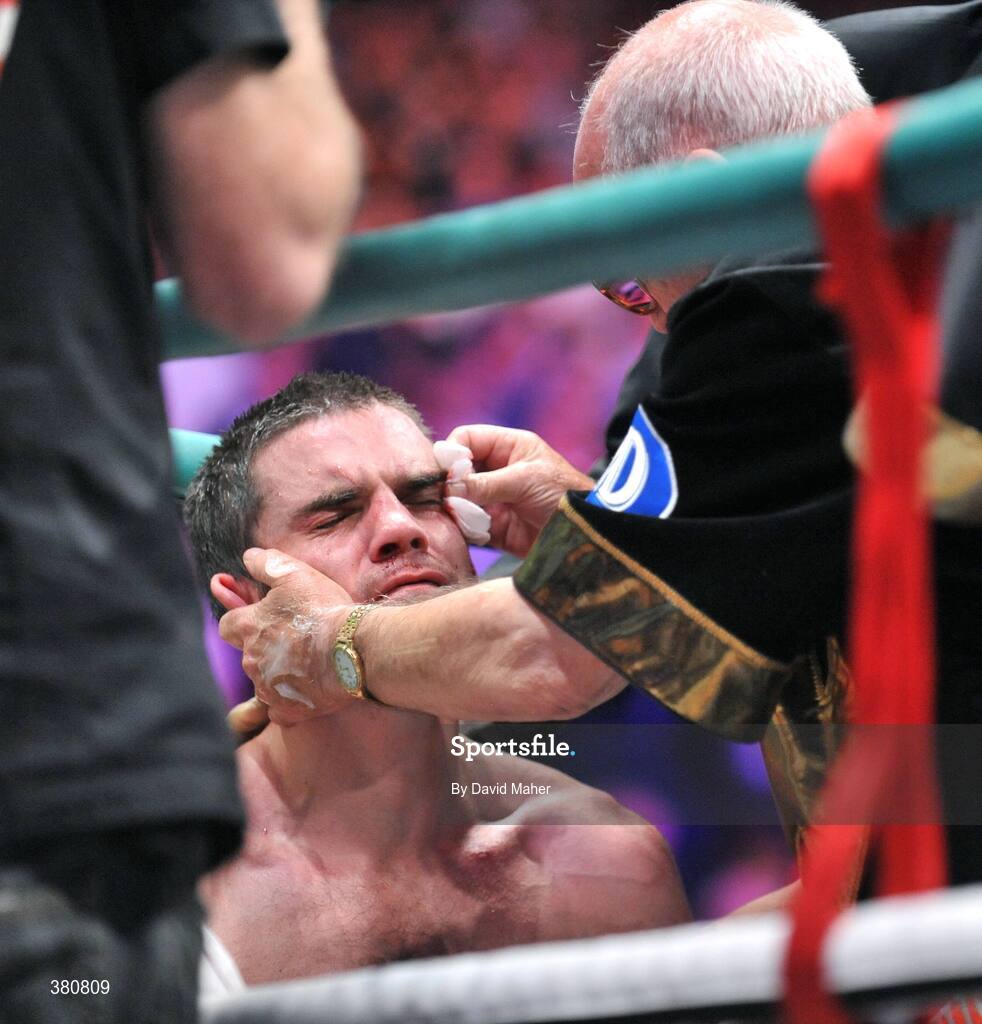 26 September 2009; Bernard Dunne is treated after being defeated by Poonsawat Kratingdaenggym on the three knockdown rule after 2 minutes 57 seconds of the third round of their WBA World Super Bantamweight title fight. Hunky Dorys World Title Fight Night, Bernard Dunne v Poonsawat Kratingdaenggym, The O2, Dublin. Picture credit: David Maher / SPORTSFILE