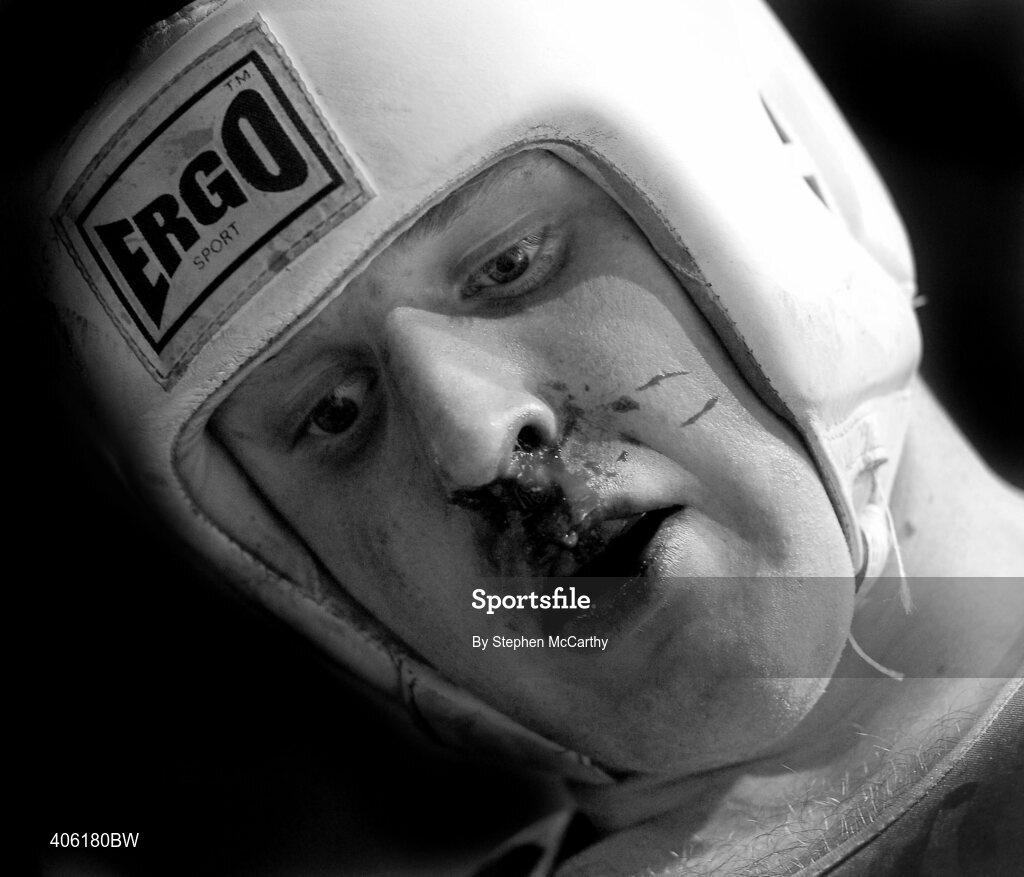 27 February 2010; Niall Forde, Eagle, supports a blood nose between rounds during his 91+kg novice quarter final bout with Peter Cassidy, Ballyhaunis. National Mens Elite Championships Semi-Finals - Saturday, National Stadium, Dublin. Picture credit: Stephen McCarthy / SPORTSFILE