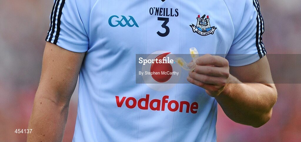 22 August 2010; Rory O'Carroll, Dublin, holds a pair of gumshields. GAA Football All-Ireland Senior Championship Semi-Final, Dublin v Cork, Croke Park, Dublin. Picture credit: Stephen McCarthy / SPORTSFILE