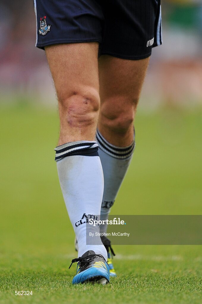 18 September 2011; Bernard Brogan, Dublin. GAA Football All-Ireland Senior Championship Final, Kerry v Dublin, Croke Park, Dublin. Picture credit: Stephen McCarthy / SPORTSFILE