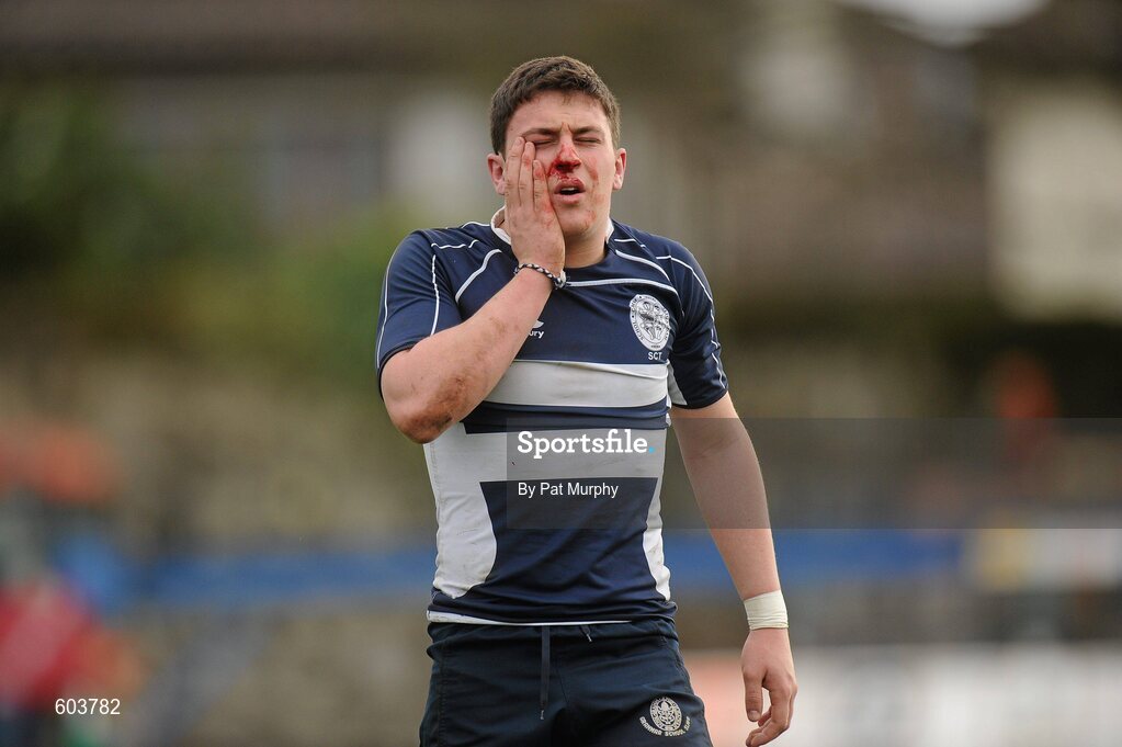 14 March 2012; Michael Green, Sligo Grammar School, leaves the field with a facial injury. Supermac's Connacht Schools Senior Cup Final, Marist College, Athlone v Sligo Grammar School, Sportsground, Galway. Picture credit: Pat Murphy / SPORTSFILE