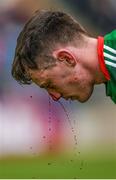 21 May 2017; (EDITORS NOTE; This image contains graphic content) Diarmuid O'Connor of Mayo after receiving a cut to his face during the Connacht GAA Football Senior Championship Quarter-Final match between Mayo and Sligo at Elvery's MacHale Park in Castlebar, Co Mayo. Photo by Stephen McCarthy/Sportsfile