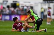 22 July 2018; Michael Daly of Galway receives medical treatment during the GAA Football All-Ireland Senior Championship Quarter-Final Group 1 Phase 2 match between Kildare and Galway at St Conleth's Park in Newbridge, Co Kildare. Photo by Sam Barnes/Sportsfile
