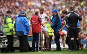 19 August 2018; James Skehill of Galway is assisted from the pitch after picking up an injury during the GAA Hurling All-Ireland Senior Championship Final between Galway and Limerick at Croke Park in Dublin. Photo by Stephen McCarthy/Sportsfile