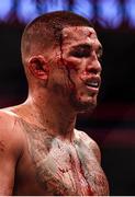 6 October 2018; Anthony Pettis following his defeat to Tony Ferguson in their UFC lightweight fight during UFC 229 at T-Mobile Arena in Las Vegas, Nevada, USA. Photo by Stephen McCarthy/Sportsfile