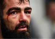 15 March 2019; Jono Carroll during a press conference following his International Boxing Federation World Super Featherweight title bout against Tevin Farmer at the Liacouras Center in Philadelphia, USA. Photo by Stephen McCarthy / Sportsfile