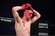 22 February 2020; Richie Smullen after losing to Alberth Dias in their featherweight bout at Bellator 240 in the 3 Arena, Dublin. Photo by David Fitzgerald/Sportsfile
