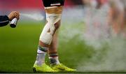 30 November 2020; Giovanni D'Onofrio of Zebre is treated for an injury during the Guinness PRO14 match between Munster and Zebre at Thomond Park in Limerick. Photo by Ramsey Cardy/Sportsfile