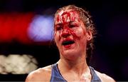 10 July 2021; Blood is seen on the forehead of Jessica Eye after an accidental clash of heads with Jennifer Maia in their flyweight fight during the UFC 264 event at T-Mobile Arena in Las Vegas, Nevada, USA. Photo by Thomas King/Sportsfile