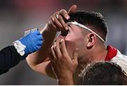 8 October 2021; David McCann of Ulster inserts a contact lens during the United Rugby Championship match between Ulster and Benetton at Kingspan Stadium in Belfast. Photo by Ramsey Cardy/Sportsfile