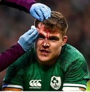 13 November 2021; (EDITORS NOTE; This image contains graphic content) Garry Ringrose of Ireland receives treatment for ahead injury during the Autumn Nations Series match between Ireland and New Zealand at Aviva Stadium in Dublin. Photo by David Fitzgerald/Sportsfile
