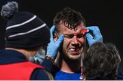 3 December 2021; Caelan Doris of Leinster is treated for a blood injury during the United Rugby Championship match between Leinster and Connacht at the RDS Arena in Dublin. Photo by Ramsey Cardy/Sportsfile