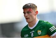 20 March 2022; Diarmuid O'Connor of Kerry leaves the pitch with a blood injury during the Allianz Football League Division 1 match between Armagh and Kerry at the Athletic Grounds in Armagh. Photo by Ramsey Cardy/Sportsfile